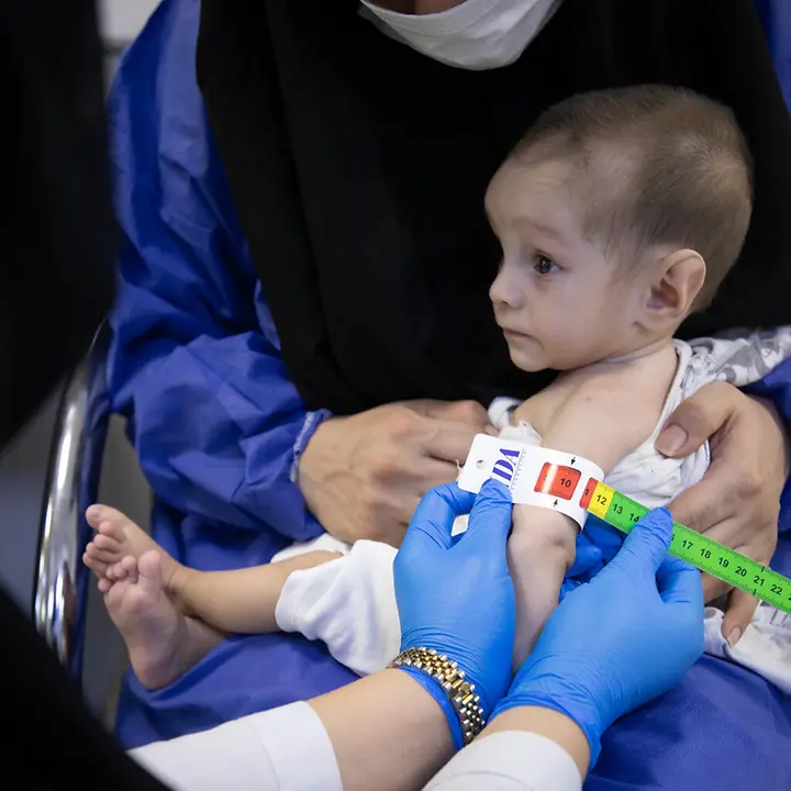 Ein Kind wird von einer Helferin auf Mangelernährung untersucht. Das Maßband zeigt den Schweregrad der Mangelernährung. | © UNICEF/Meerzad Afghanistan Hunger: Eine Helferin untersucht ein Kind mit Hilfe eines speziellen Maßbandes auf Mangelernährung.
