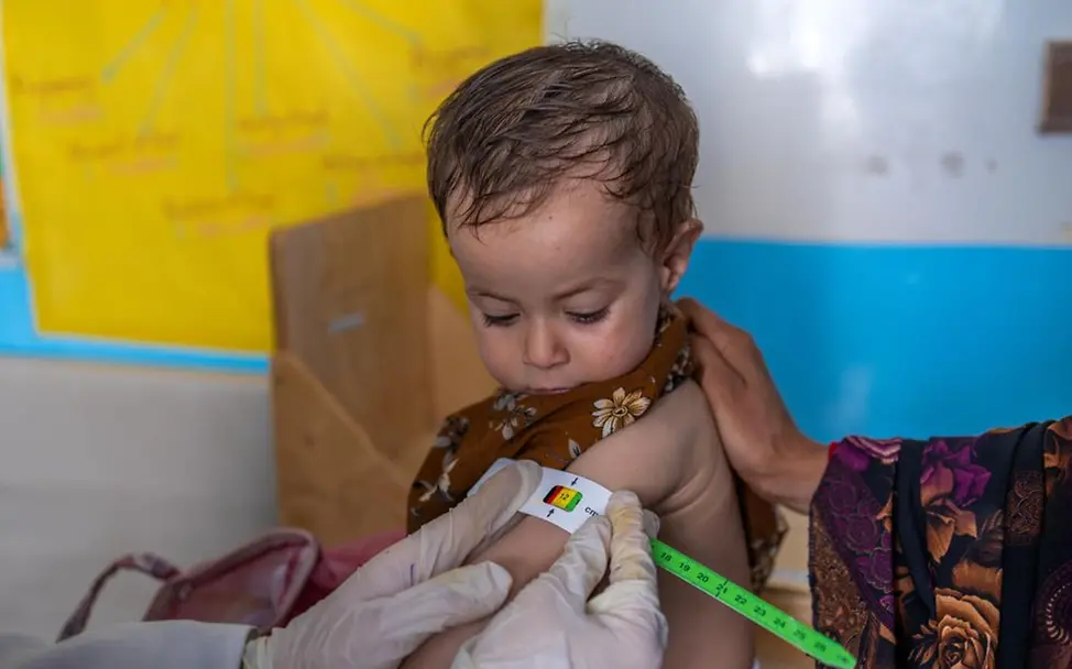 Die einjährige Zainab wird wegen ihrer Mangelernährung untersucht. | © UNICEF Afghanistan Hunger: Mit einem speziellen Maßband misst eine Helferin den Zustand der einjährigen Zaina an ihrem Oberarm.