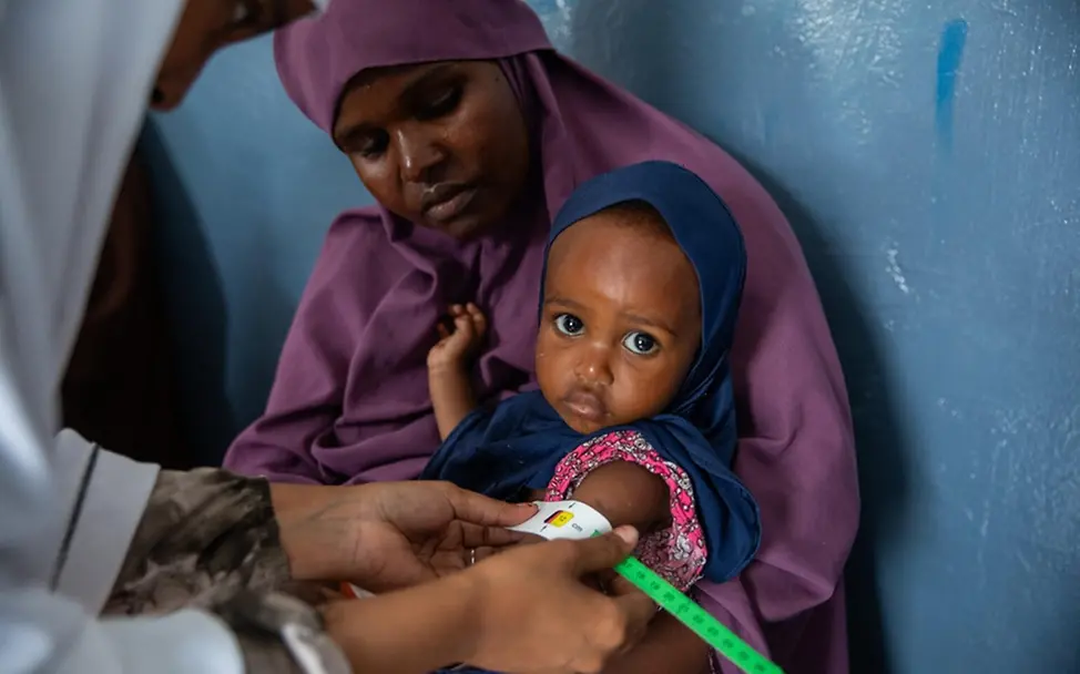 Maida Abdullahi (18 Monate) wird im Krankenhaus in Mogadischu auf Mangelernährung untersucht.