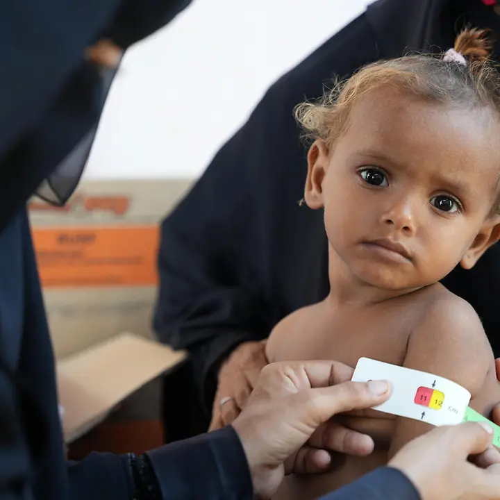 Hunderttausende Kinder im Jemen sind lebensbedrohlich mangelernährt. | © UNICEF/ Hunger im Jemen: Ein Kleinkind wird mittels Oberarmmessung auf Mangelernährung untersucht.