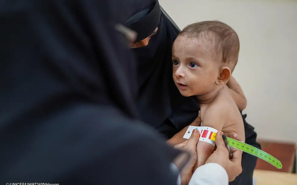Mangelernährung kann die körperliche und geistige Entwicklung von Kindern langfristig gefährden. | © UNICEF/Hayyan Hunger im Jemen: Ein Baby wird auf dem Arm seiner Mutter auf Mangelernährung untersucht.