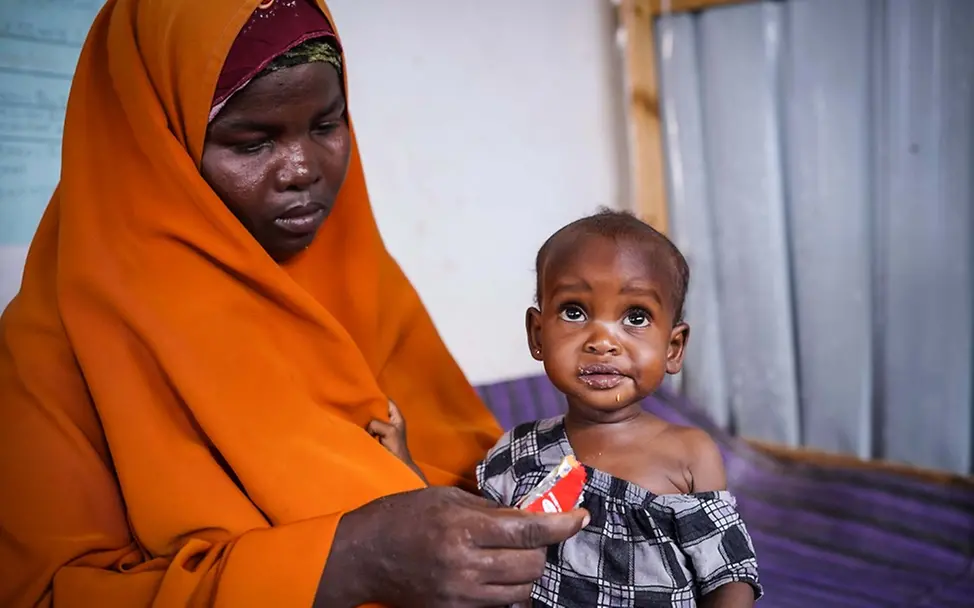 Drohende Hungersnot in Somalia: Fadumo (2) isst Erdnusspaste