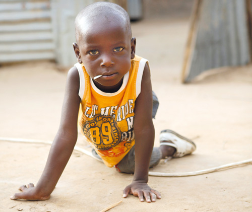 Idriss Moussa ist als Baby an Polio erkrankt. | ©UNICEF UK/Chad/Irby Idriss Moussa ist als Baby an Polio erkrankt.