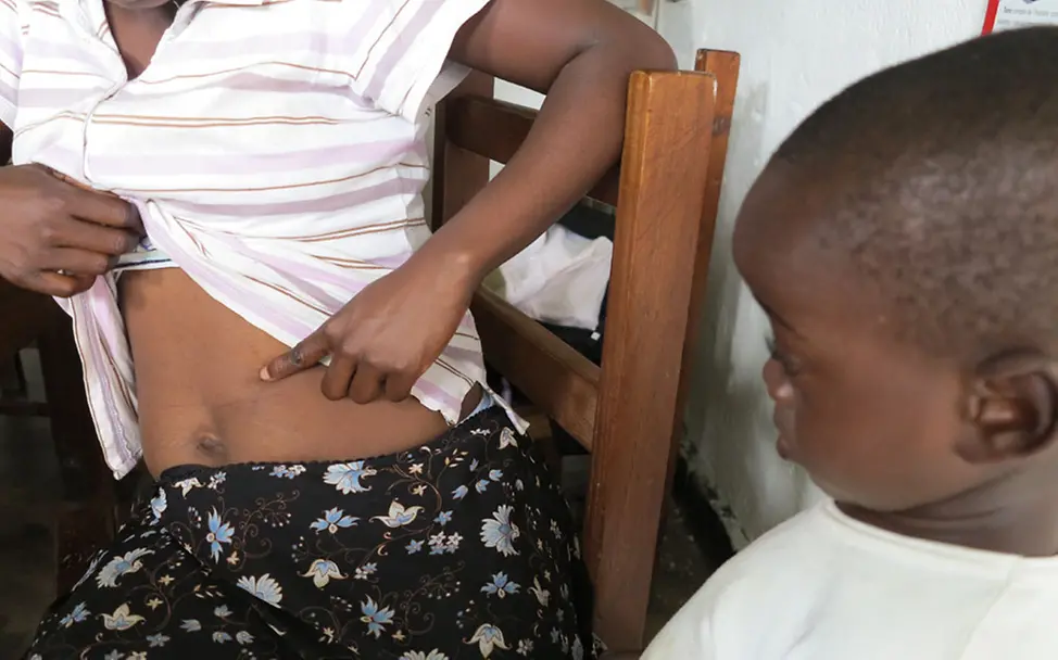 Chiku zeigt ihre Verletzungen. | © UNICEF/Maria von Welser Chiku zeigt ihre Verletzungen.