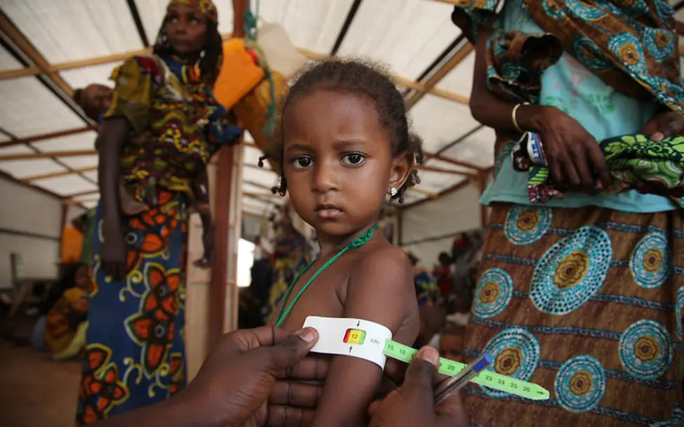 Mangelernährung wir ein zunehmendes Problem | © UNICEF CAR/Roger LeMoyne Mangelernährung Zentralafrikanische Republik