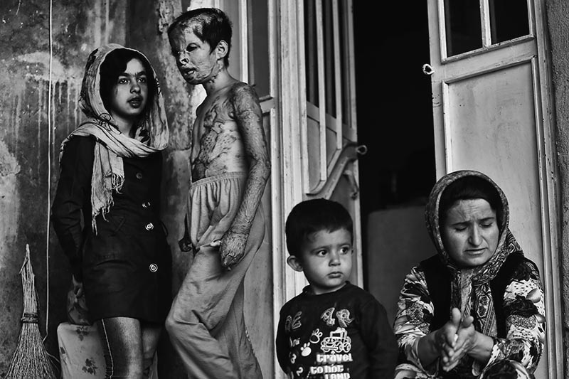 Iran: Giving children their faces back! | © Abdollah Heidari/Mehr News Agency