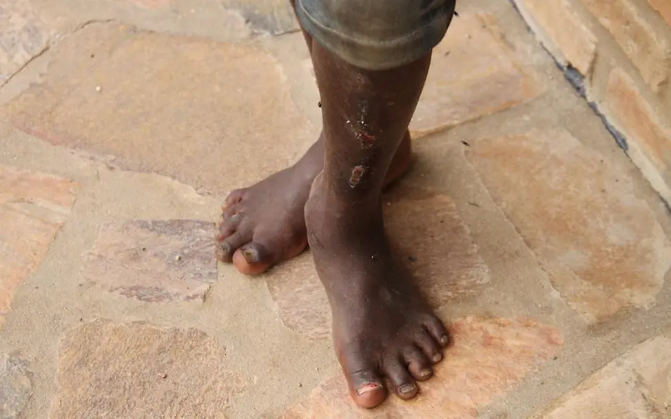 Burundi Krise: Straßenkinder vor Gewalt schützen