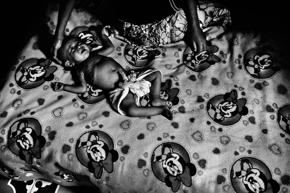 Guatemala: Gezeichnet durch chronische Unterernährung | ©JM Lopez/Freier Fotograf Guatemala: Gezeichnet durch chronische Unterernährung
