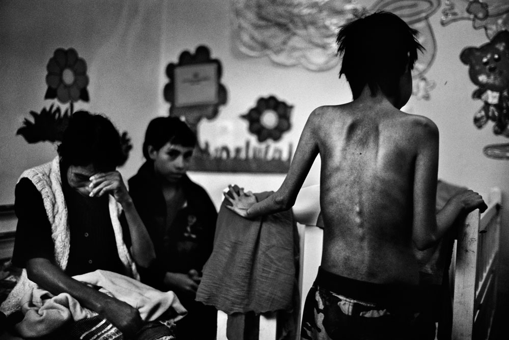 Guatemala: Marked by malnutrition | ©JM Lopez/Freelance Photographer Guatemala: Marked by malnutrition