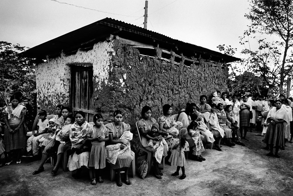 Guatemala: Marked by malnutrition | ©JM Lopez/Freelance Photographer Guatemala: Marked by malnutrition