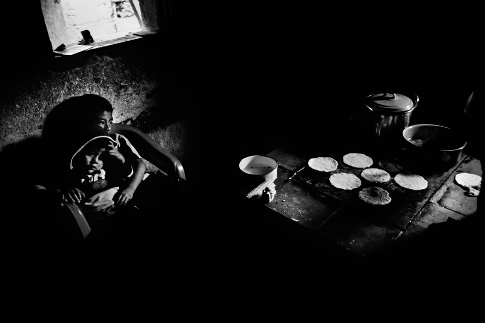Guatemala: Marked by malnutrition | ©JM Lopez/Freelance Photographer Guatemala: Marked by malnutrition