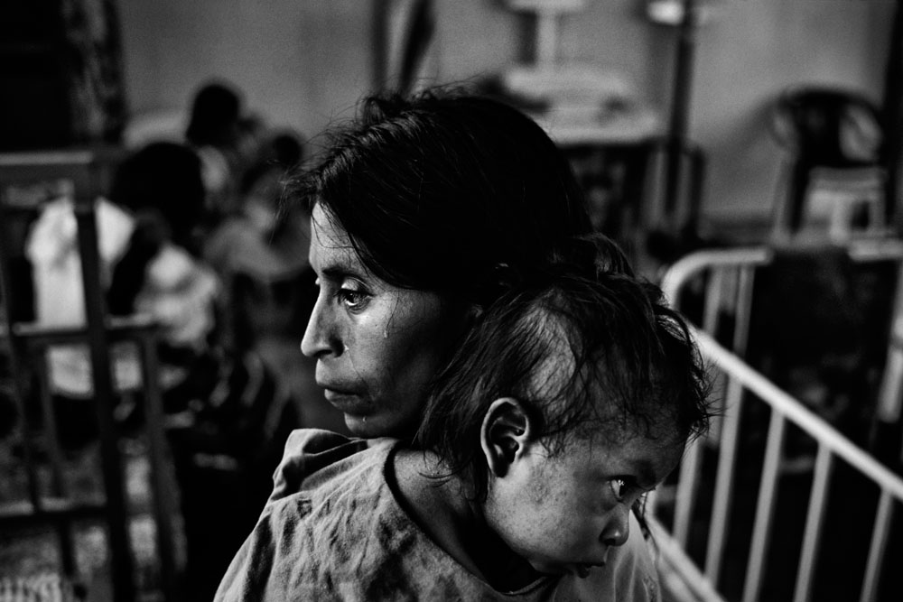 Guatemala: Marked by malnutrition
