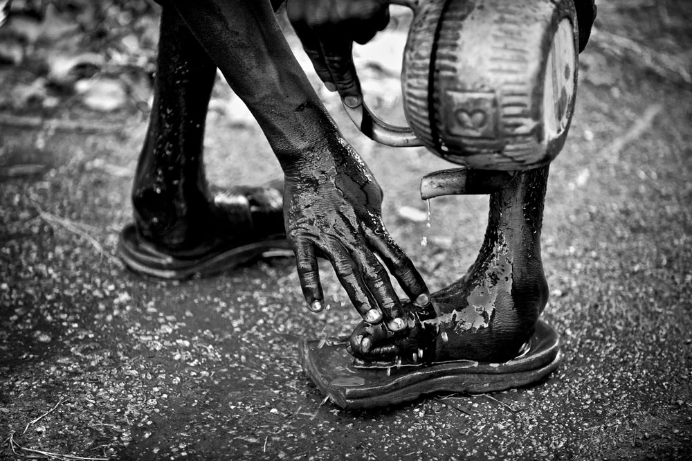 Nigeria: Polio – one step forward, two steps back | © Mary F. Calvert/Zuma Press Nigeria: Polio – one step forward, two steps back | © Mary F. Calvert/Zuma Press