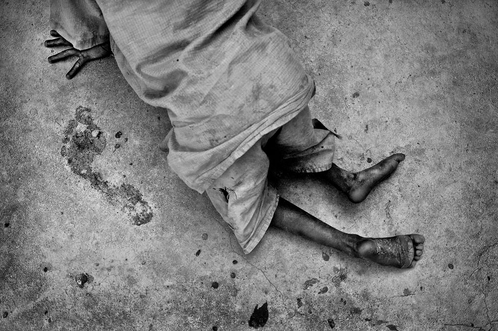 Nigeria: Polio – one step forward, two steps back | © Mary F. Calvert/Zuma Press