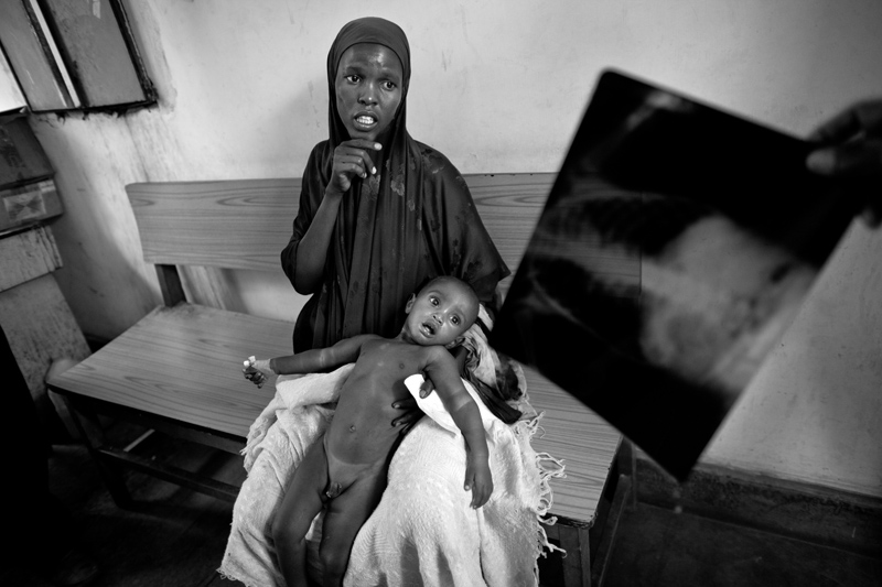 Somalia: Immer wieder Krieg, Hunger und Tod | © Hossein Fatemi/Panos Pictures Somalia: Immer wieder Krieg, Hunger und Tod