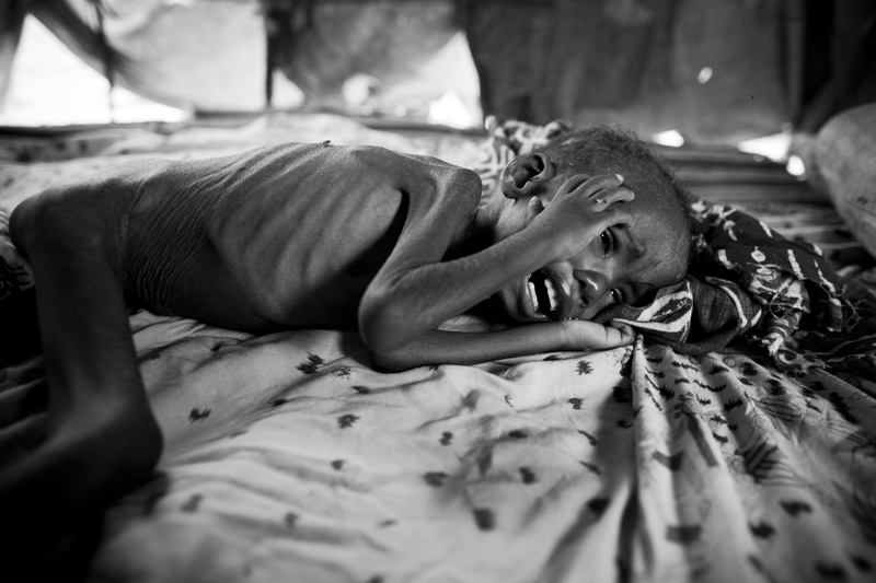Somalia: Never ending war, hunger an death | © Hossein Fatemi/Panos Pictures Agency Somalia: Never ending war, hunger an death