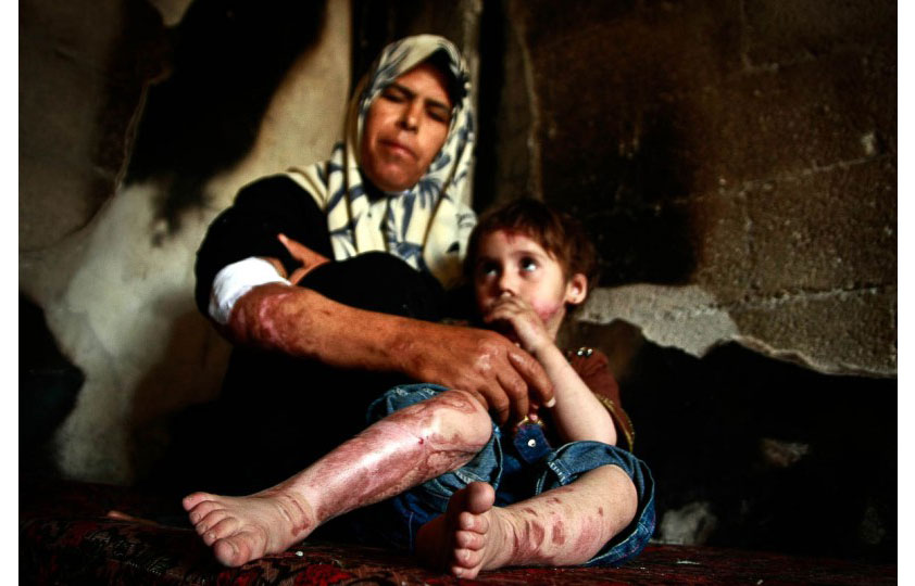 Playing despite war | © Eman Mohammed/Freelance Photographer Playing despite war