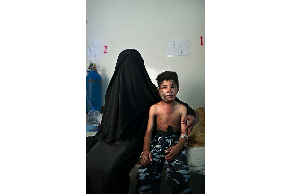 Yemen: Between life and death | © Veronique de Viguerie, France (Freelance Photographer) Yemen: Between life and death