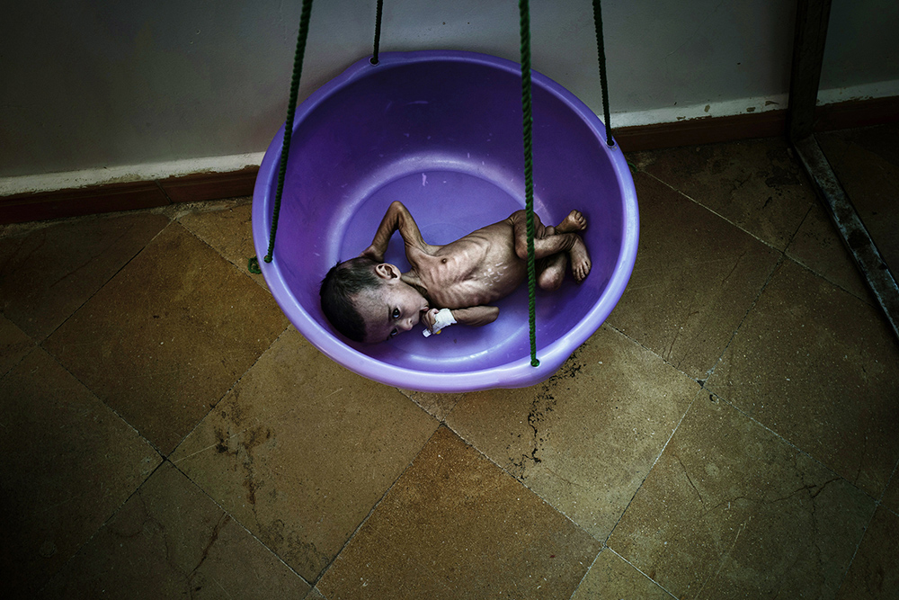 Yemen: Between life and death | © Veronique de Viguerie, France (Freelance Photographer) Yemen: Between life and death