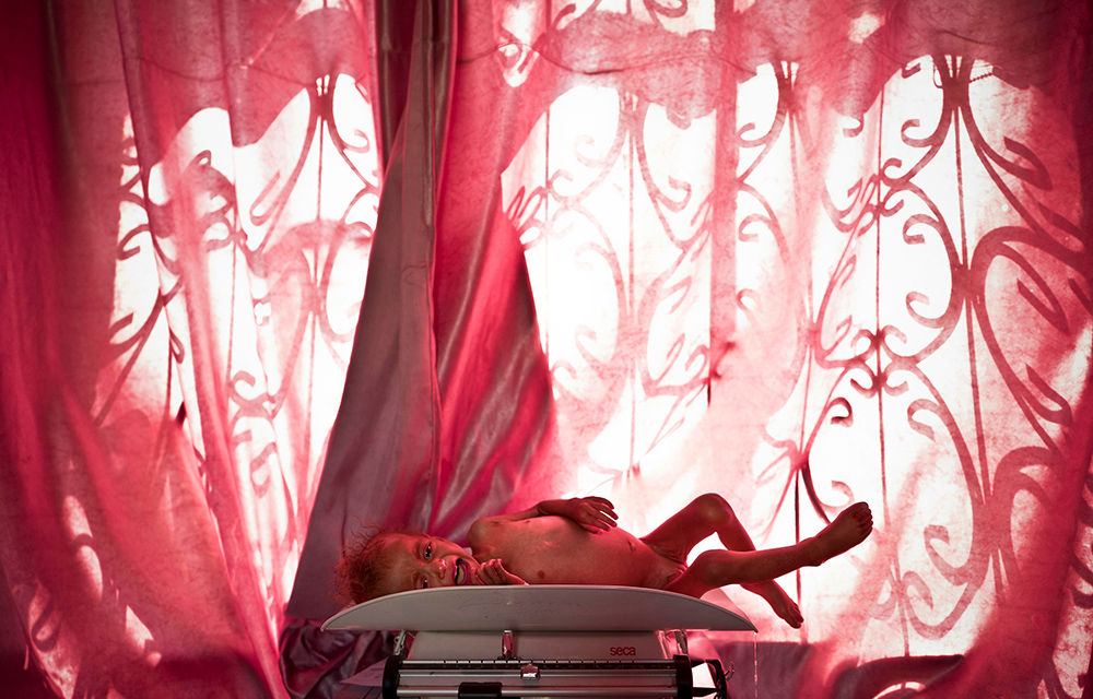 Yemen: Between life and death | © Veronique de Viguerie, France (Freelance Photographer) Yemen: Between life and death