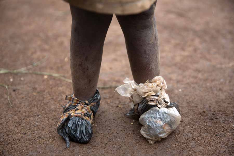 Demokratische Republik Kongo: 15 km von Bunia entfernt trägt ein Flüchtlingskind trägt provisorische Schuhe. | © UNICEF/Oatway Ein Flüchtlingskind trägt provisorische Schuhe aus Plastiktüten in der Demokratische Republik Kongo.