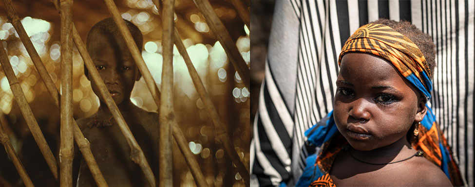 Collage: links: Ein Junge beobachtet durch Holzstäbe, rechts: Ein Kleinkind mit Haarband nach der Impfung.