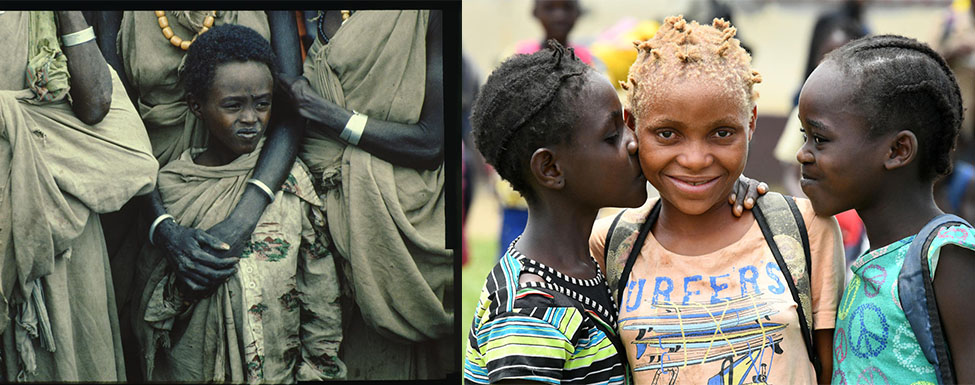 Collage: Ein Kind sucht Schutz bei seiner Mutter und ein Albinomädchen mit ihren Freundinnen.