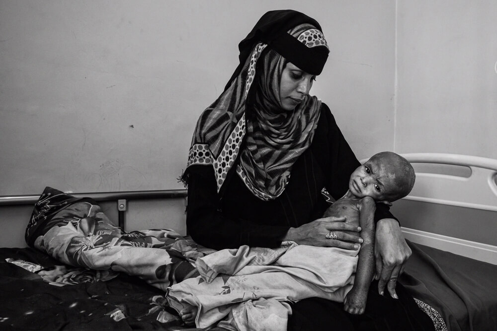 Jemen: Fawaz im Arm seiner Mutter