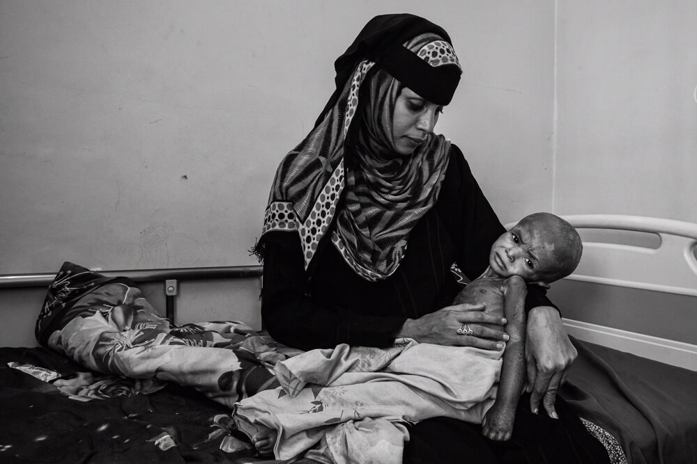 Fawaz im Arm seiner Mutter | © Giles Clarke for UNOCHA Jemen: Fawaz im Arm seiner Mutter