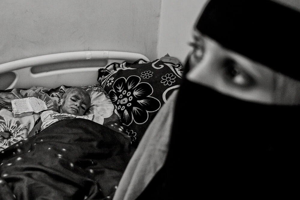 Fawaz war lebensbedrohlich mangelernährt | © Giles Clarke for UNOCHA Jemen: Fawaz erschöpft im Bett mit seiner Mutter