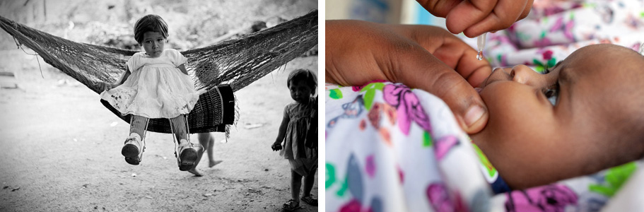 75 Jahre UNICEF: Mädchen sitzt mit Beinschienen in Hängematte und Baby erhält Schluckimpfung
