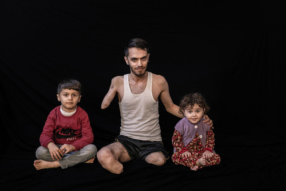 Irak: Leben mit der Verletzung
