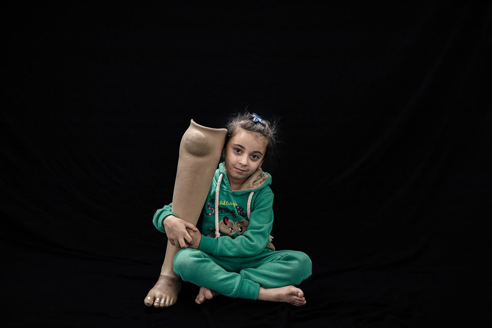 Iraq: Open wounds | © Younes Mohammad, Iraq (Middle East Images agency) Iraq: Open wounds