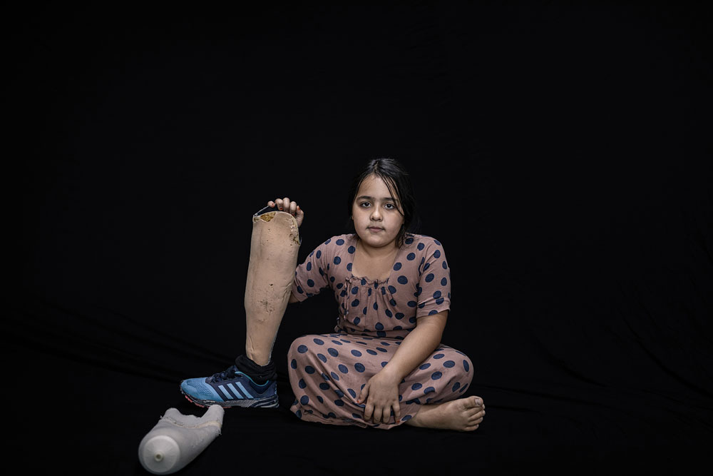 Iraq: Open wounds | © Younes Mohammad, Iraq (Middle East Images agency) Iraq: Open wounds