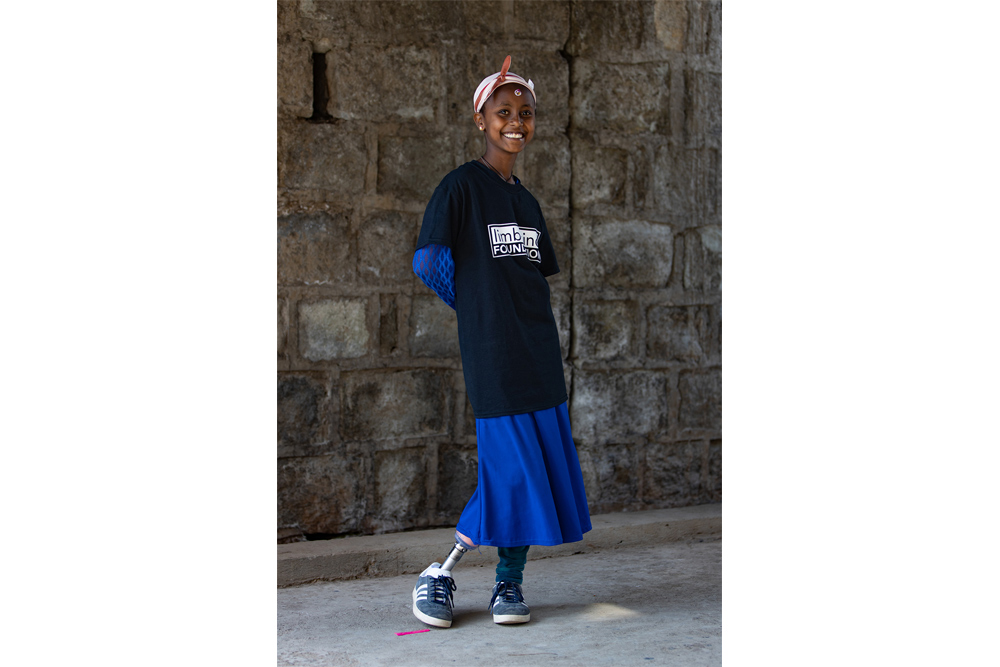 Philippines, Ethiopia, Haiti: Bringing mobility to children with limb loss