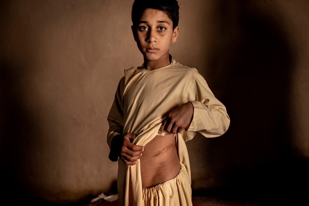 Afghanistan: The Price of Peace | © Mads Nissen, Denmark, Politiken, Agentur laif Afghanistan: The Price of Peace