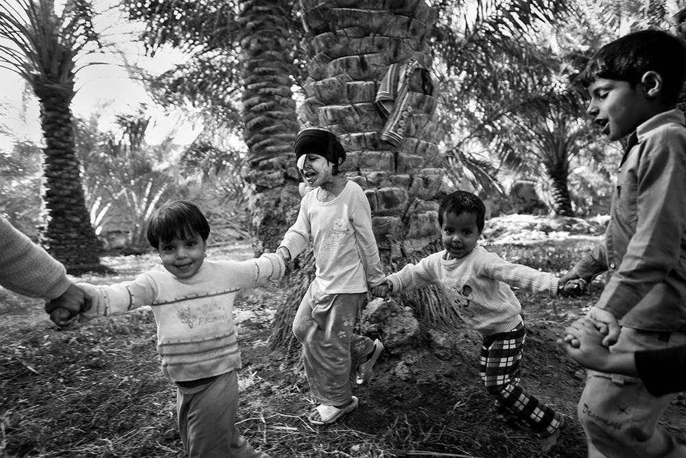 Säureopfer Iran. © Younes Khani/Mehr News Agency Säureopfer Iran. © Younes Khani/Mehr News Agency