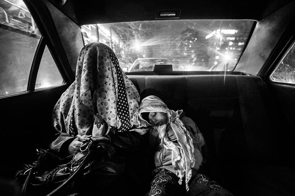 Säureopfer Iran. © Younes Khani/Mehr News Agency