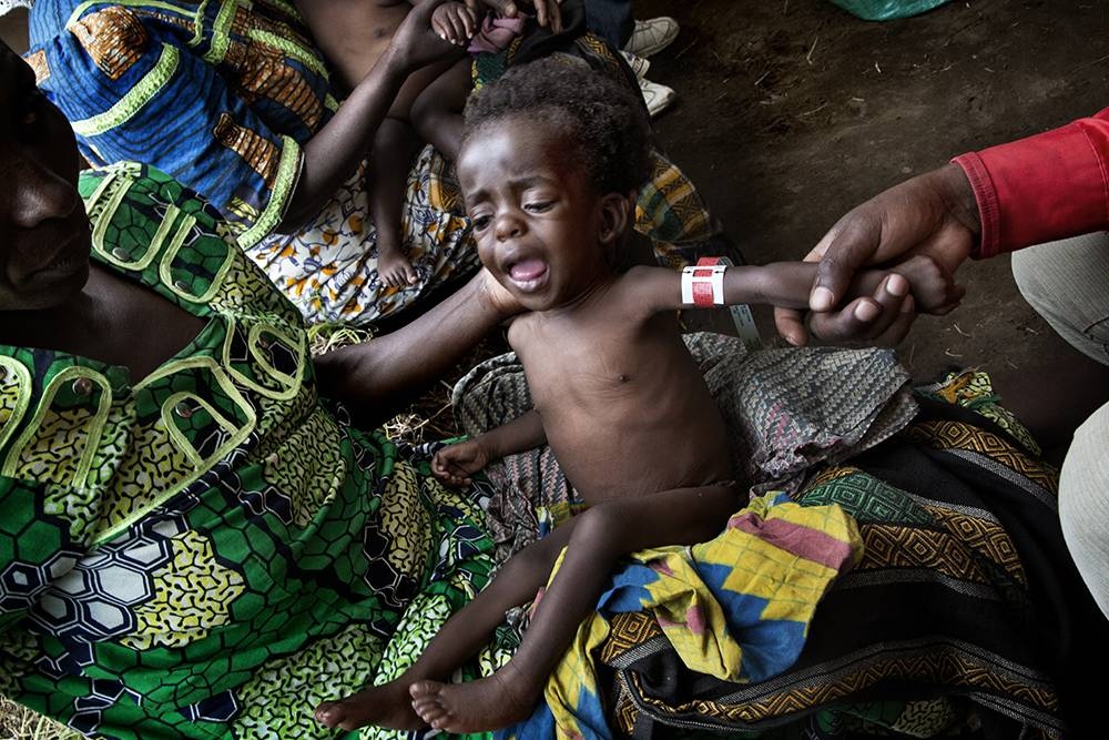 Kongo: Der Preis des Fortschritts | © Marcus Bleasdale/Agentur VII