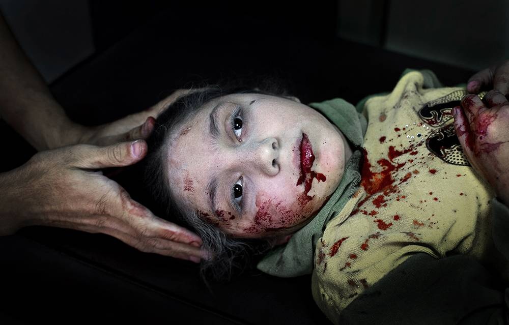 Syrien: Das vergessene Leid der Kinder. © Niclas Hammarström/Kontinent Syrien: Das vergessene Leid der Kinder. © Niclas Hammarström/Kontinent