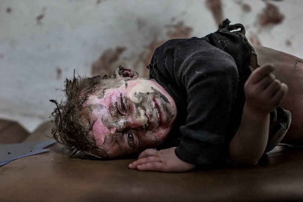 Syrien: Das vergessene Leid der Kinder. © Niclas Hammarström/Kontinent Syrien: Das vergessene Leid der Kinder. © Niclas Hammarström/Kontinent