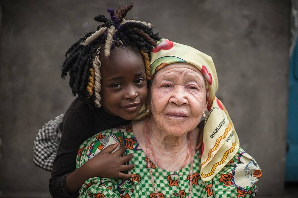 Congo: Albinism - White Ebony | © Patricia Willocq/Corbis Images Congo: Albinism - White Ebony | © Patricia Willocq/Corbis Images