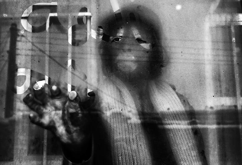 Iran: Giving children their faces back! | © Abdollah Heidari/Mehr News Agency Iran: Giving children their faces back! | © Abdollah Heidari/Mehr News Agency
