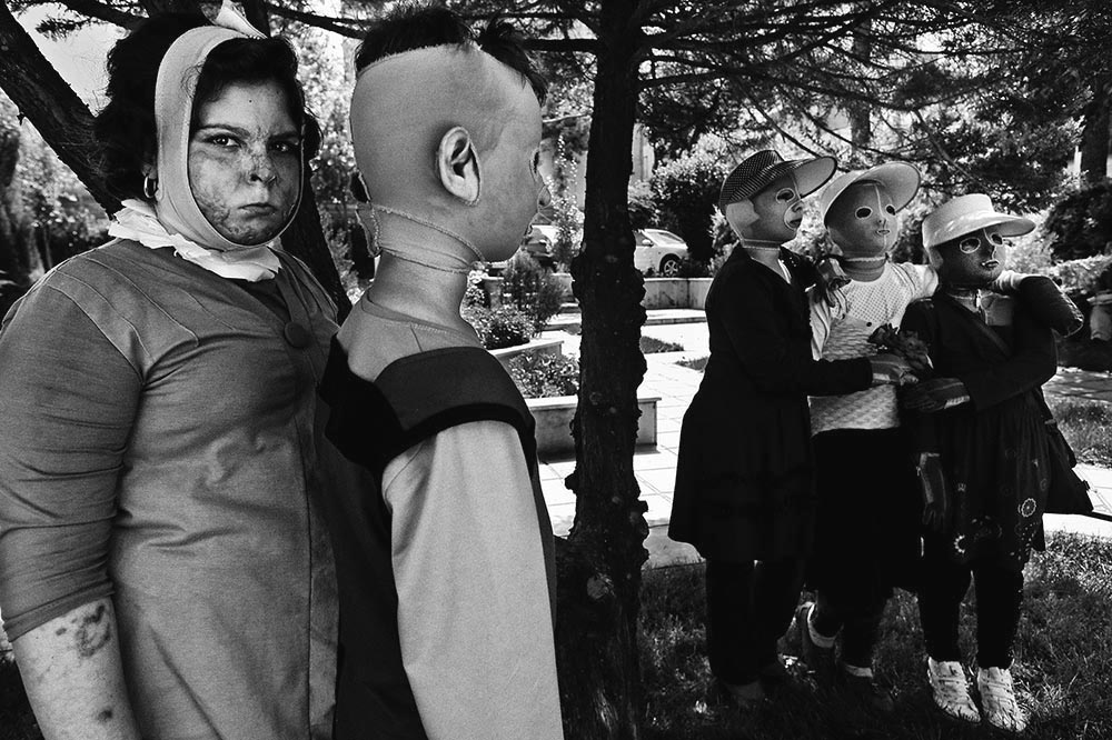 Iran: Giving children their faces back! | © Abdollah Heidari/Mehr News Agency Iran: Giving children their faces back! | © Abdollah Heidari/Mehr News Agency