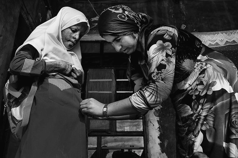 Iran: Giving children their faces back! | © Abdollah Heidari/Mehr News Agency Iran: Giving children their faces back! | © Abdollah Heidari/Mehr News Agency