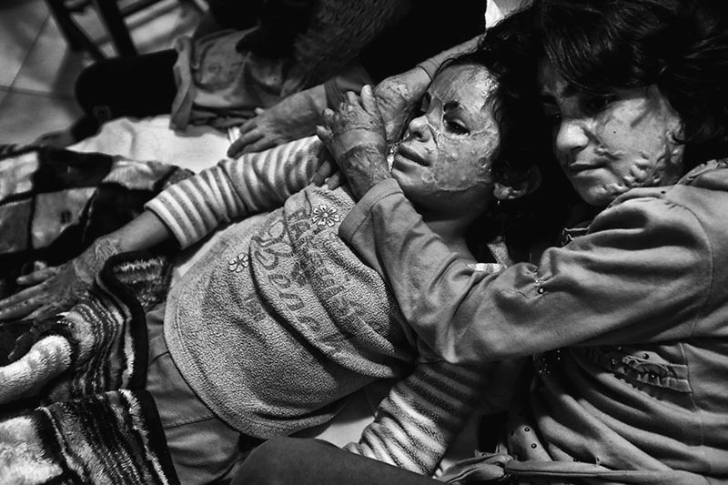 Iran: Giving children their faces back! | © Abdollah Heidari/Mehr News Agency