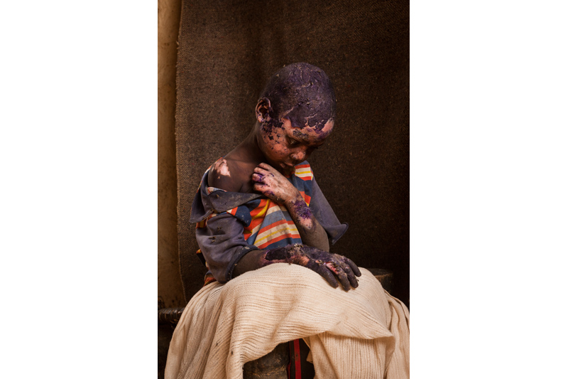 Sudan: The forgotten war | © Adriane Ohanesian (Freelance Photographer)