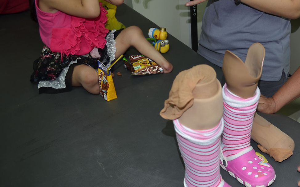 Umgang mit Behinderung: Saisai erhält Prothesen und lernt, mit ihnen zu laufen.