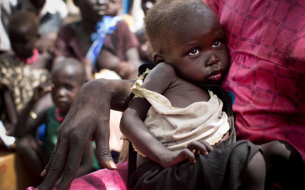 Südsudan Hungersnot: Eine Mutter im Südsudan hält ihr schwer mangelernährtes Kind