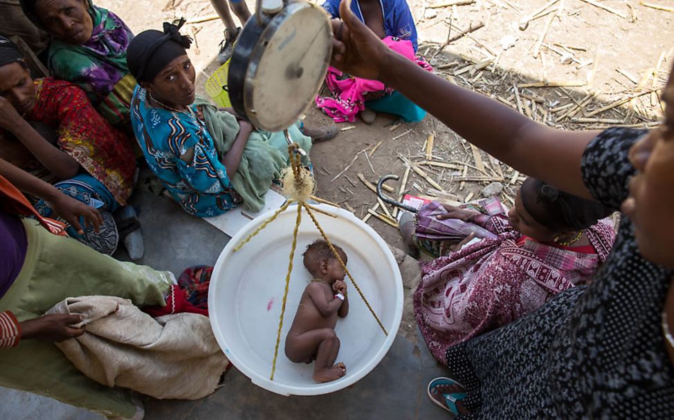 El Niño Äthiopien: Ein unterernährtes Kind liegt in der UNICEF Hängewaage.